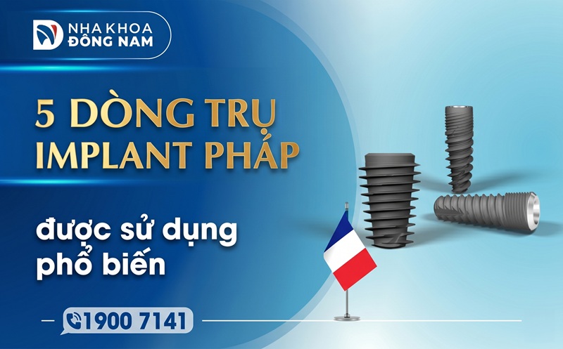 top 5 dòng trụ implant pháp được sử dụng phổ biến