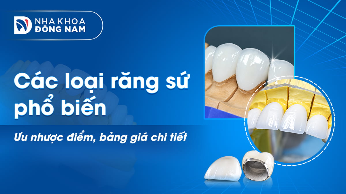 các loại răng sứ phổ biến ưu nhược điểm bảng giá