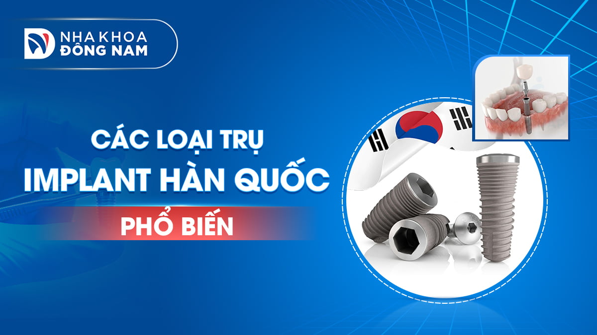 các loại trụ implant hàn quốc phổ biến