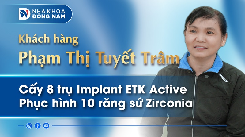 cau chuyen khach hang cua co tuyet tram