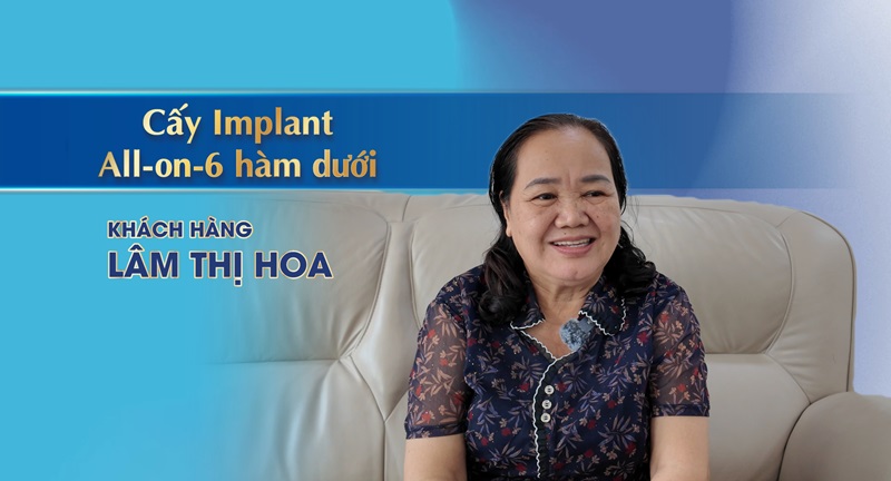 Cô Lâm Thị Hoa cấy Implant All-on-6 và phục hình răng sứ Titan tại Nha Khoa Đông Nam