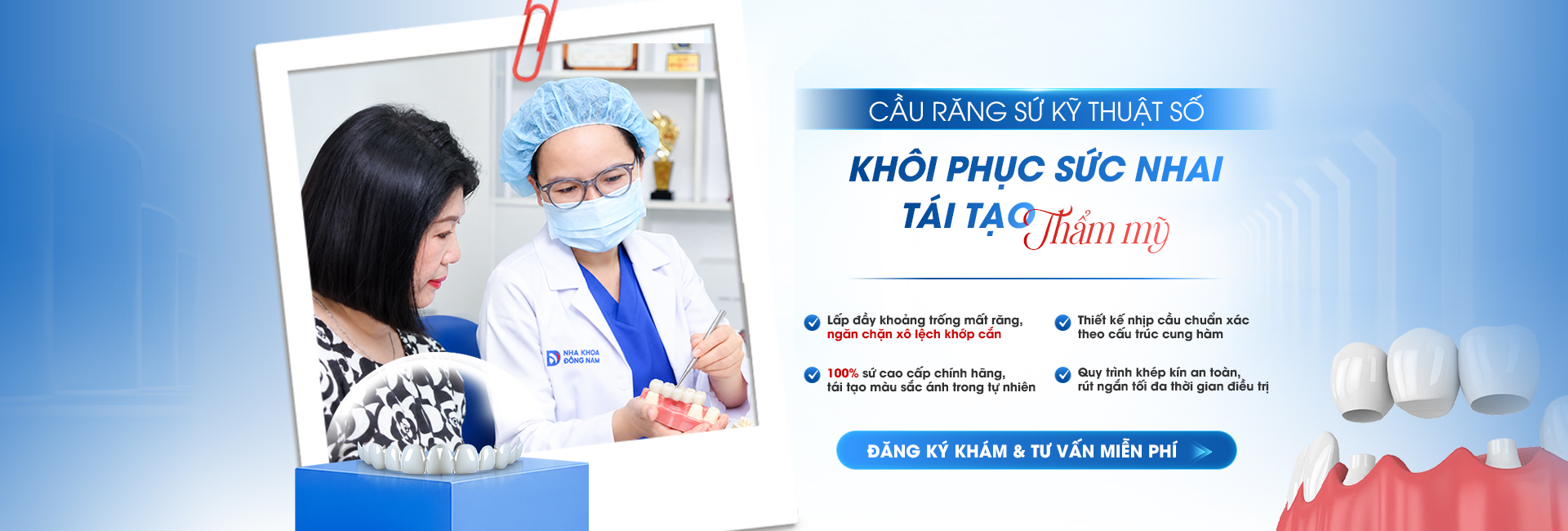 Cầu răng sứ kỹ thuật số tại Nha Khoa Đông Nam – khôi phục sức nhai, tái tạo thẩm mỹ, đăng ký khám và tư vấn miễn phí