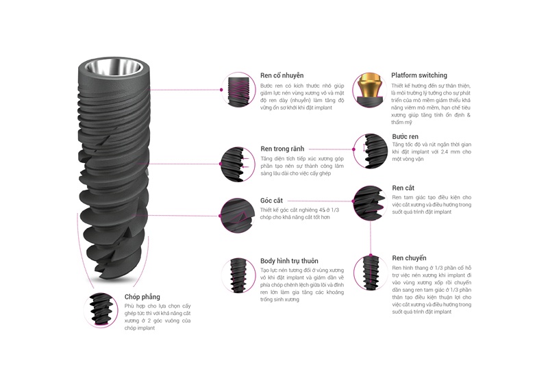 Implant ETK Active có tốc độ tích hợp xương hàm nhanh chóng