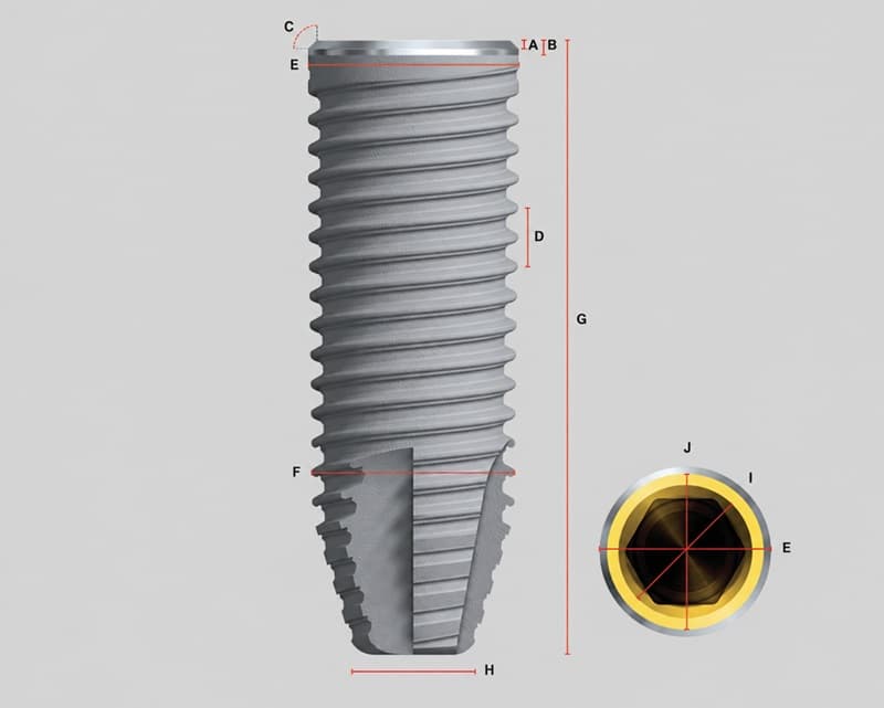 cấu tạo trụ implant nobel thụy điển