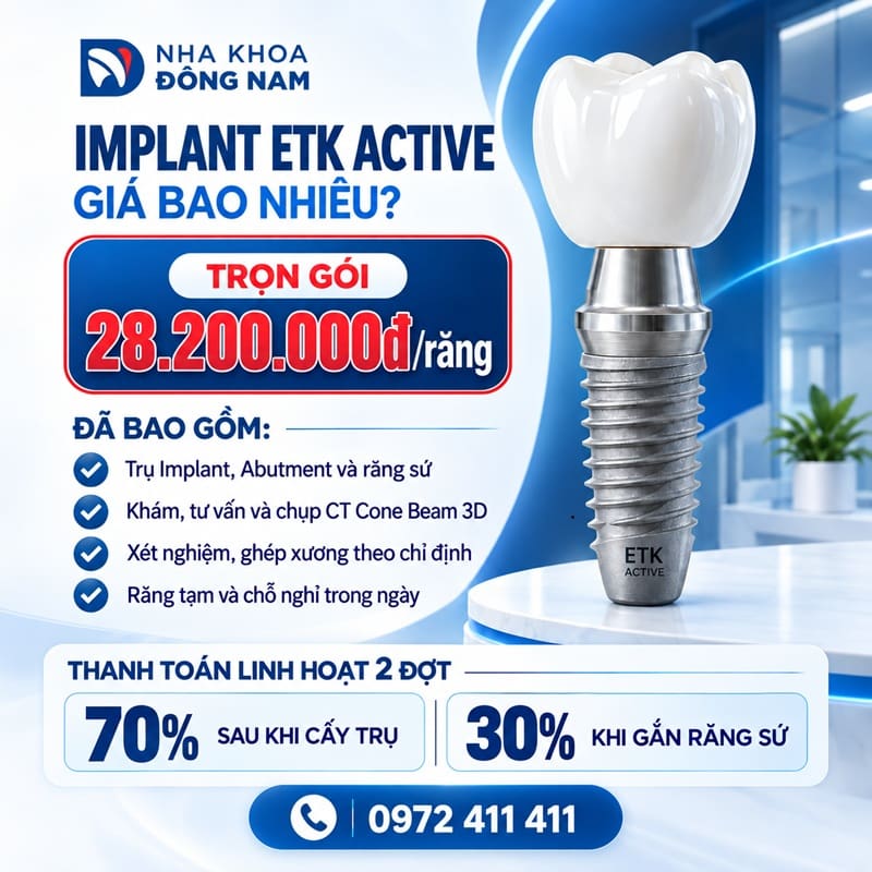 chi phí trồng răng etk active trọn gói