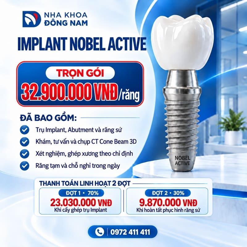 chi phí trồng răng nobel trọn gói