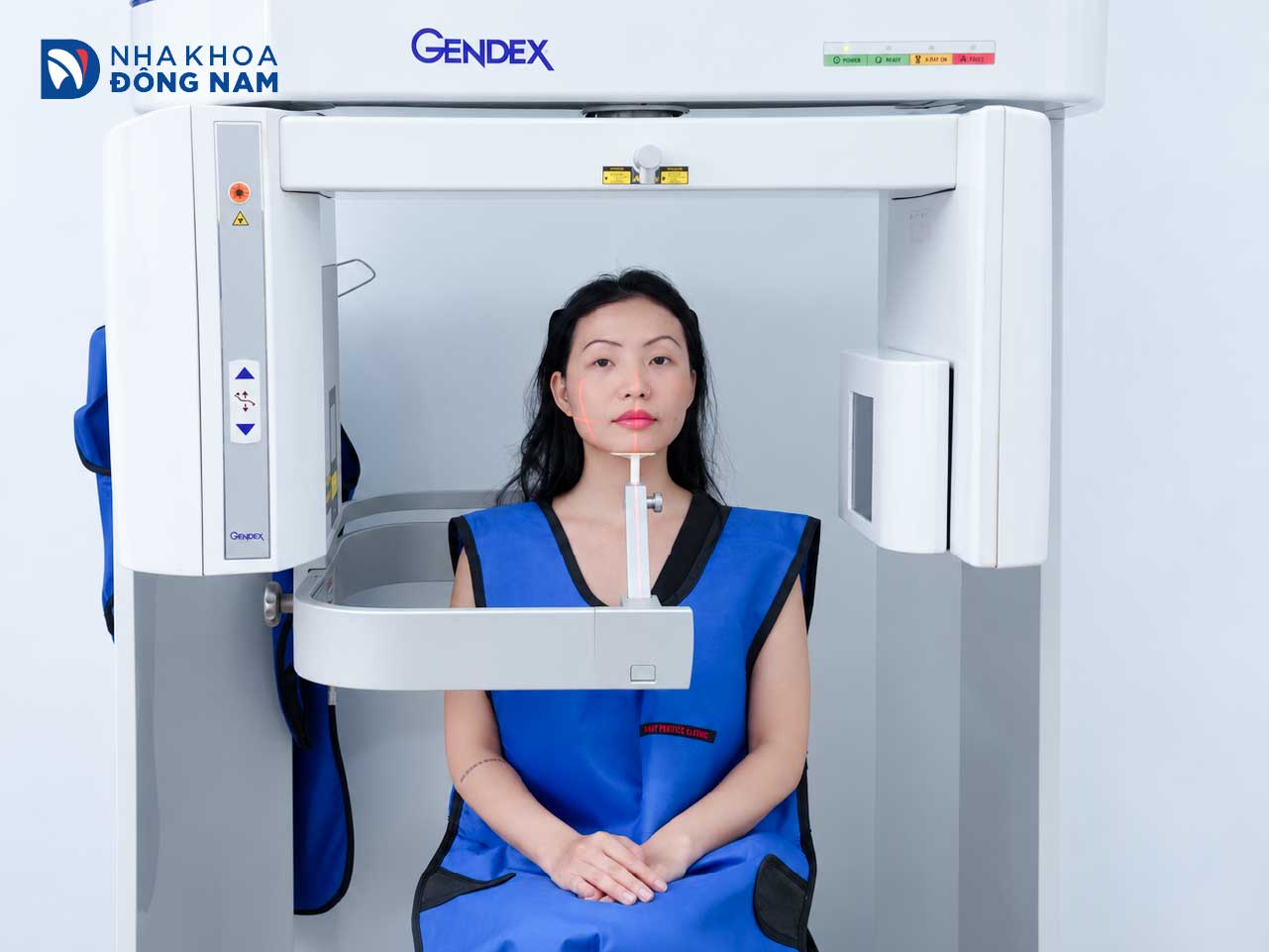 Máy chụp CT Cone Beam 3D tại Nha Khoa Đông Nam hỗ trợ chẩn đoán trước khi nhổ răng khôn