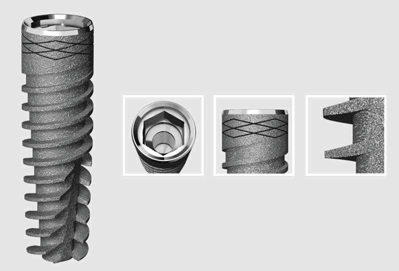 Công nghệ xử lý vùng cổ Implant