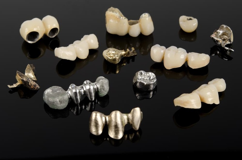 dựa vào cấu tạo răng sứ được chia thành 2 loại cơ bản