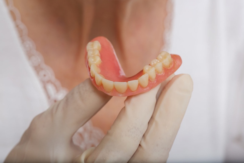 Sau một thời gian sử dụng hàm tháo lắp trở nên lỏng lẻo