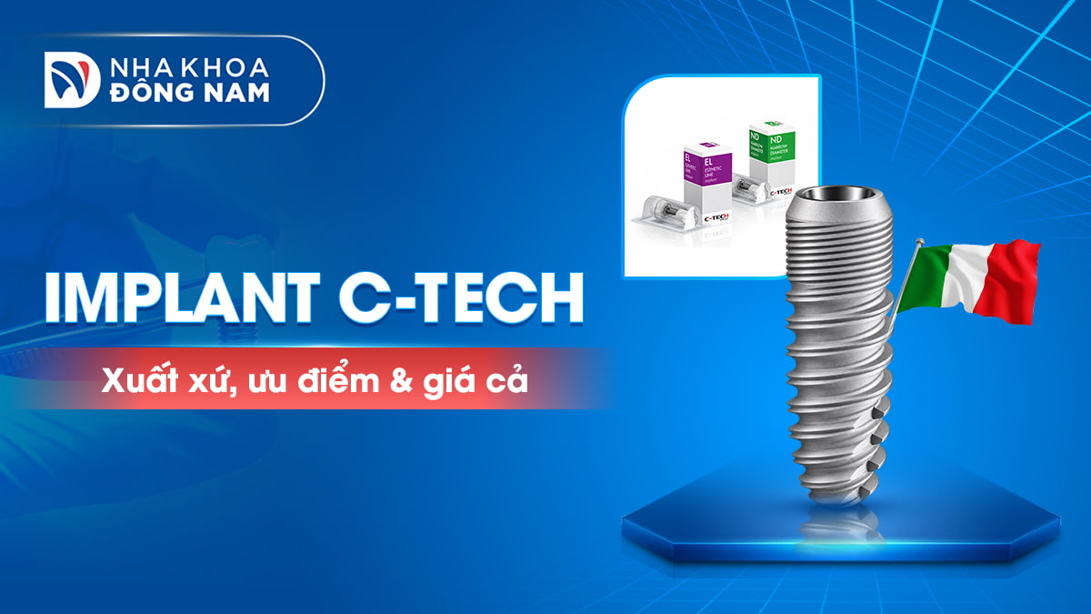 implant ctech ý xuất xứ ưu điểm giá cả