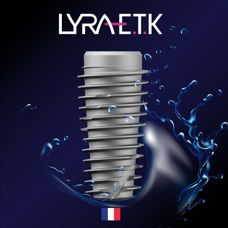 implant etk active là dòng implant cao cấp của pháp