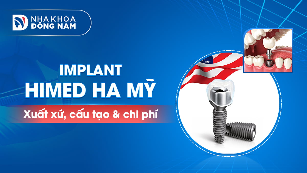 implant himed ha mỹ xuất xứ cấu tạo chi phí
