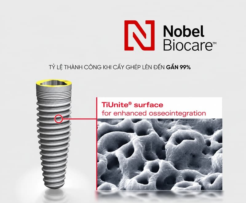 implant nobel là lựa chọn hàng đầu cho các ca cấy ghép toàn hàm phức tạp
