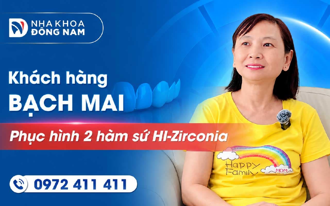 Khách hàng Bạch Mai tái khám sau 6 năm phục hình sứ 2 hàm