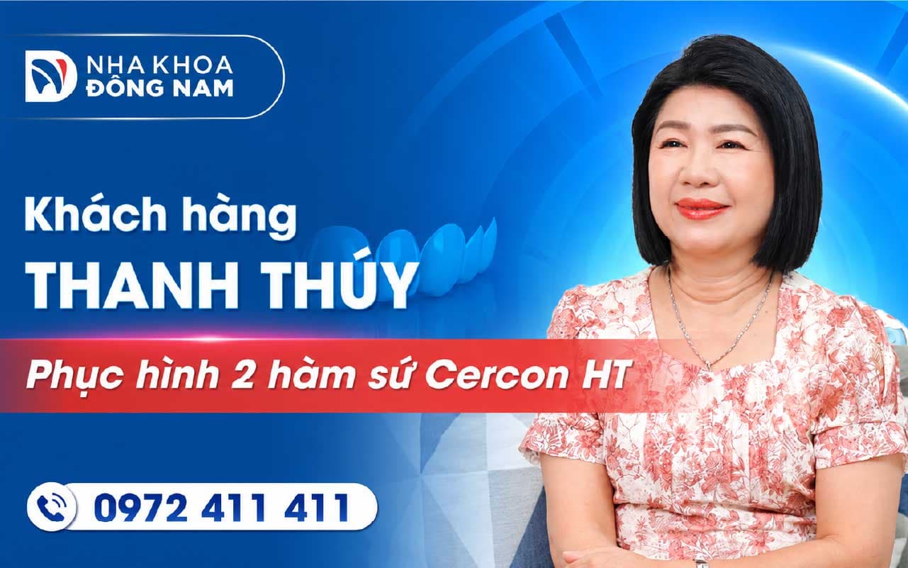 Khách hàng Thanh Thủy bọc răng sứ thẩm mỹ 2 hàm