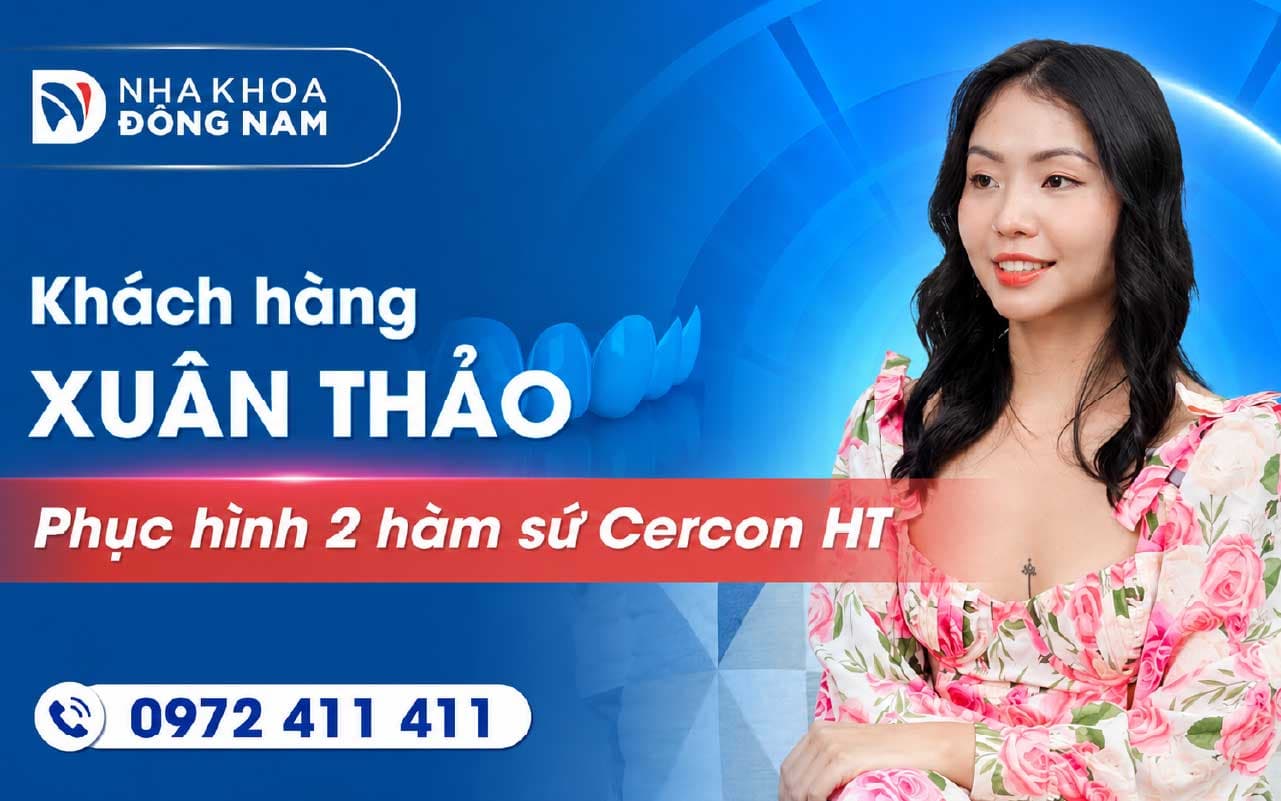 Khách hàng Xuân Thảo bọc răng sứ thẩm mỹ 2 hàm