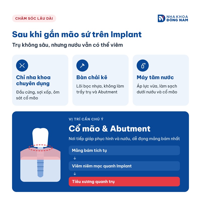 chăm sóc lâu dài sau khi gắn mão sứ trên implant