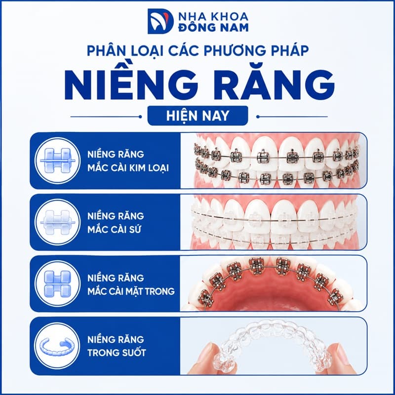 phân loại các phương pháp niềng răng