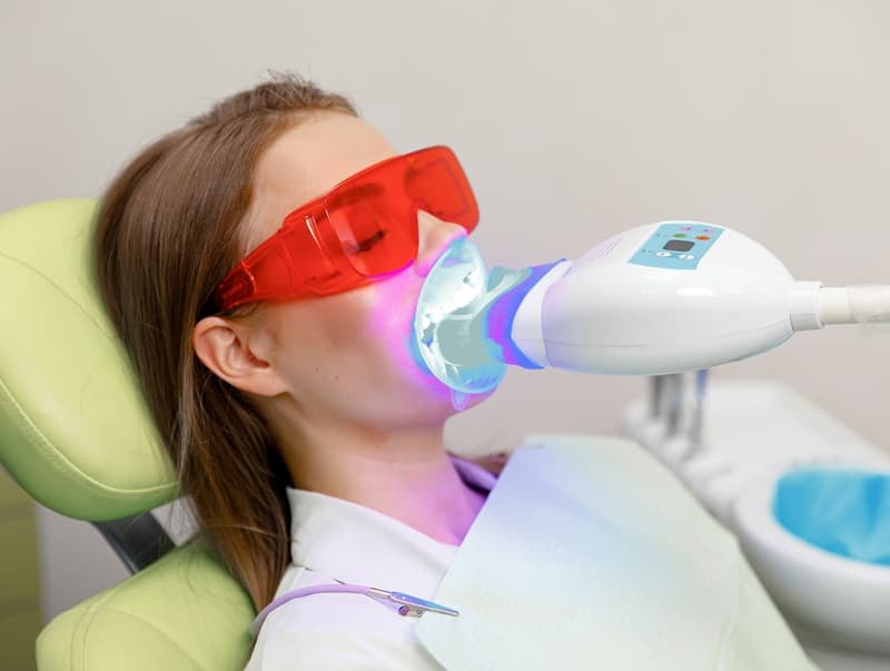 Tẩy trắng răng sử dụng các hoạt chất có khả năng oxy hóa để làm trắng răng