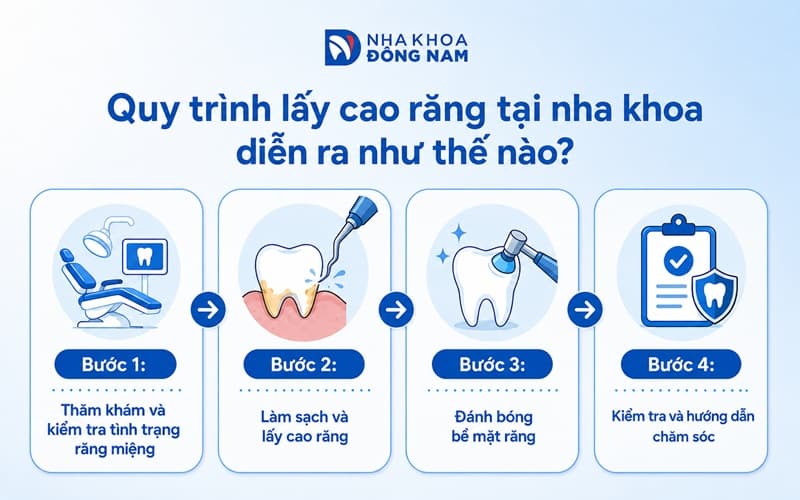 Quy trình cạo vôi răng chuẩn y khoa
