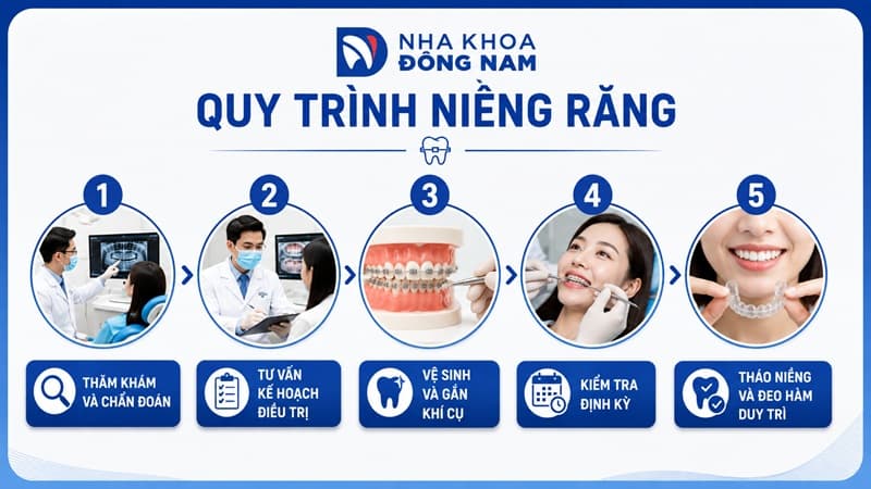 quy trình niềng răng chuẩn y khoa