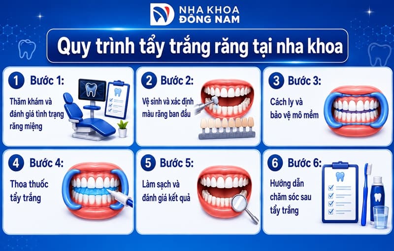 Quy trình tẩy trắng răng tại nha khoa