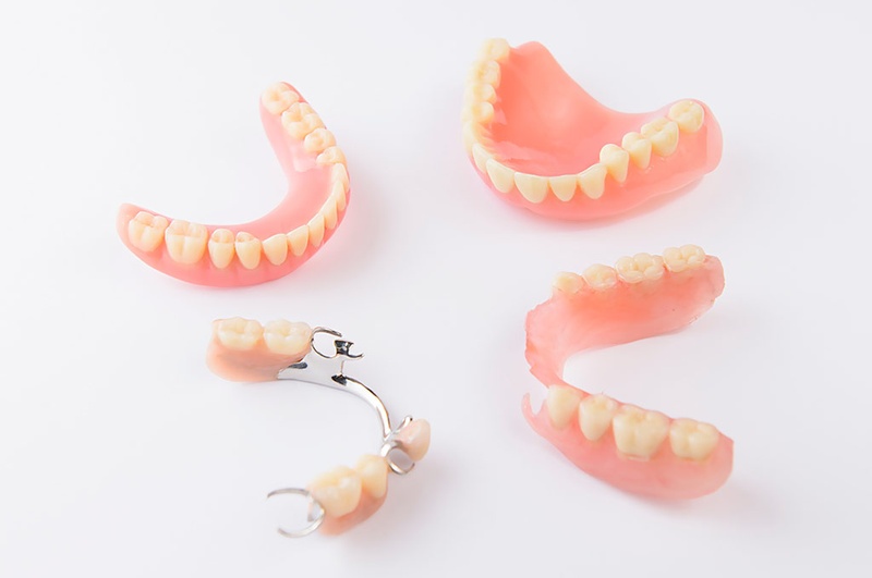 răng giả tháo lắp có quy trình thực hiện khá đơn giản