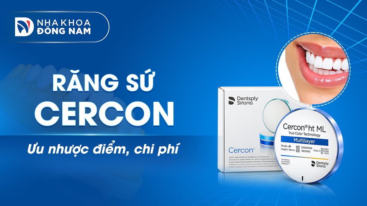 răng sứ cercon ưu nhược điểm chi phí