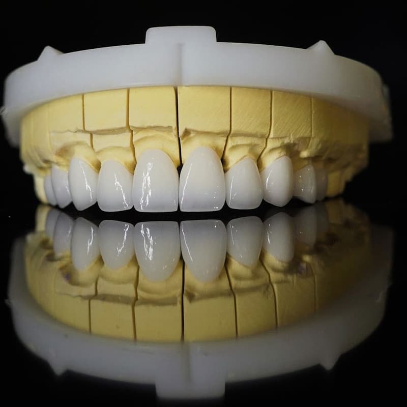 răng sứ lava được phát triển bởi tập đoàn 3m