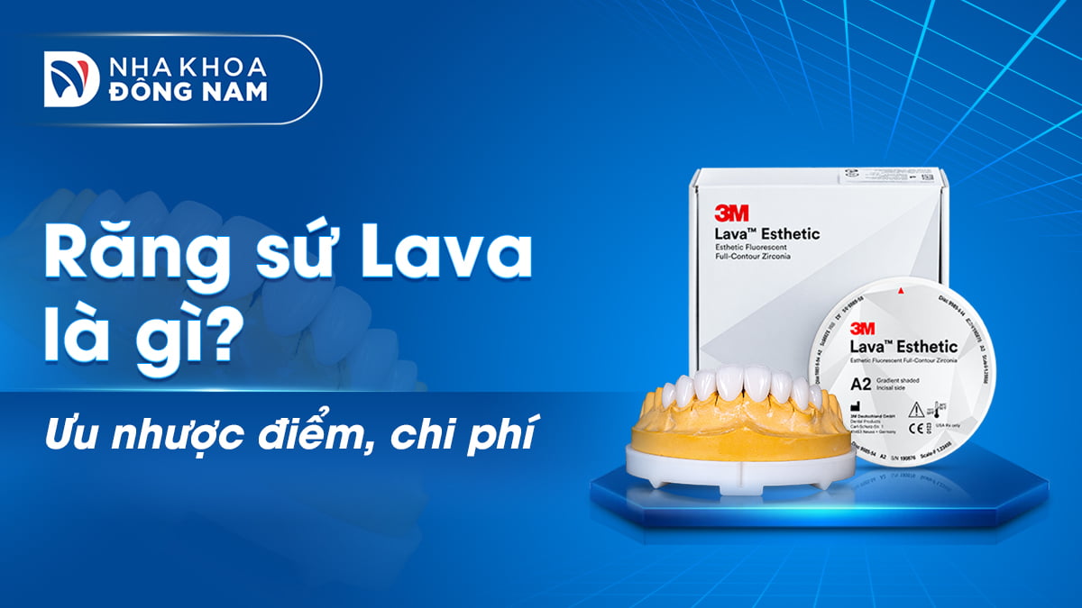 răng sứ lava là gì ưu nhược điểm chi phí