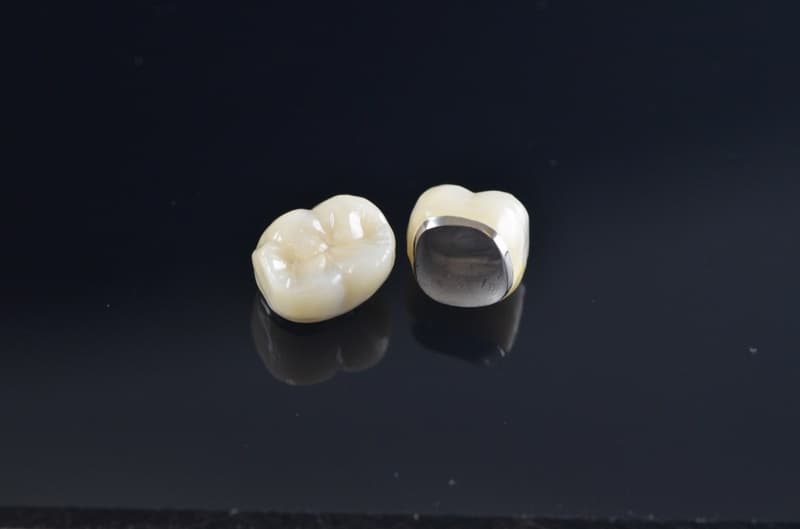răng sứ titan được bổ sung thành phần titanium giúp tăng độ bền và lành tính
