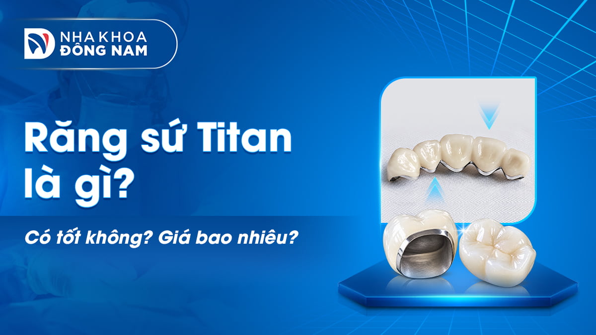 răng sứ titan là gì có tốt không giá bao nhiêu