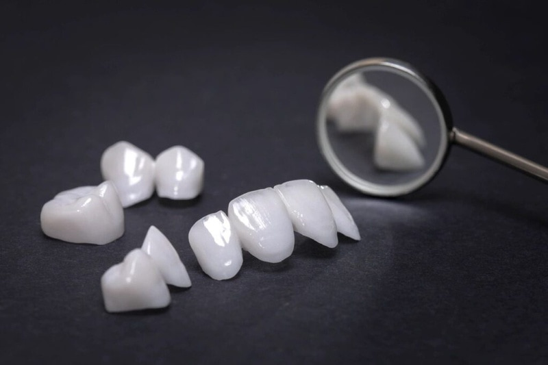 răng toàn sứ cấu tạo hoàn toàn từ sứ nguyên khối