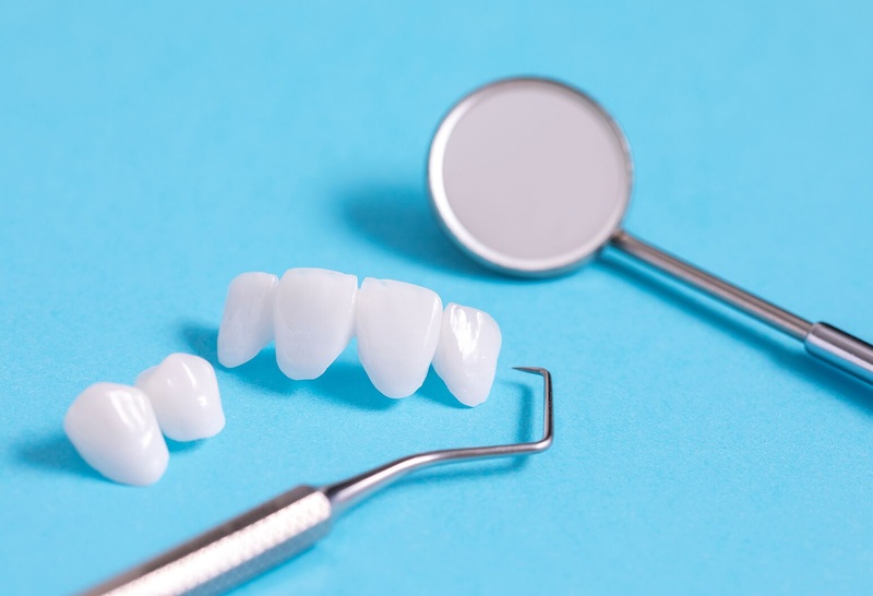 răng toàn sứ giúp khắc phục các nhược điểm của răng sứ kim loại