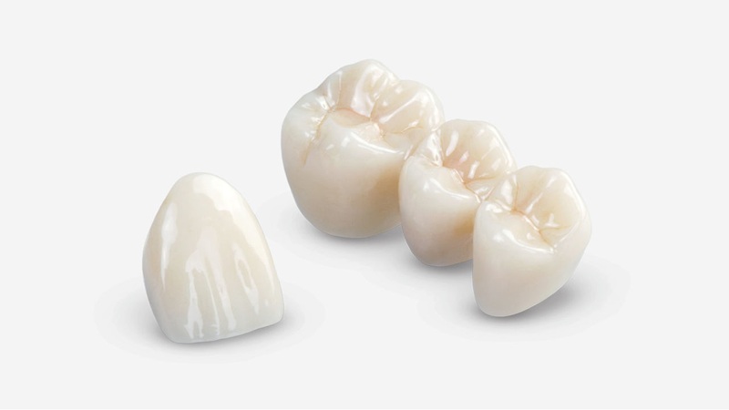 răng toàn sứ zirconia