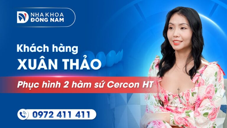 Khách hàng Xuân Thảo bọc răng sứ thẩm mỹ 2 hàm