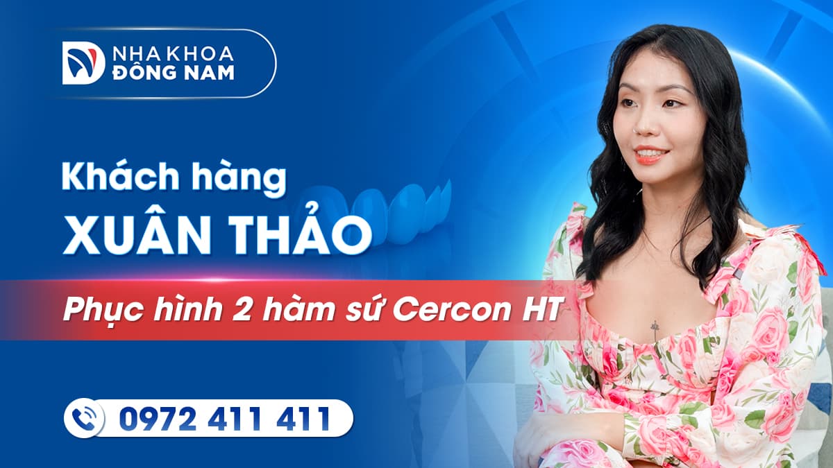 review chị xuân thảo bọc răng sứ thẩm mỹ 2 hàm