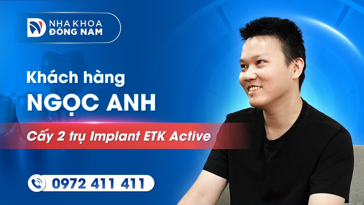 review khách hàng anh huỳnh ngọc anh cấy 2 trụ implant etk active