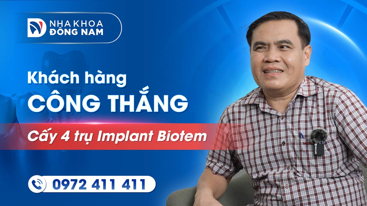 review khách hàng chú công thắng cấy 4 trụ implaint hàn quốc