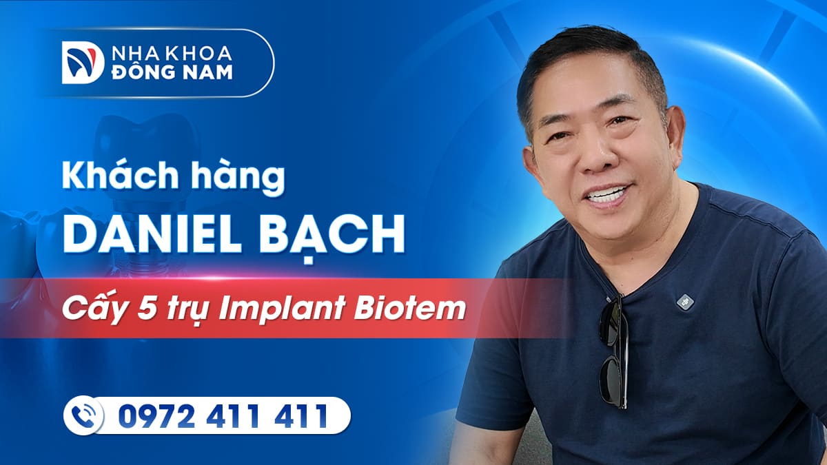 review khách hàng chú daniel bạch cấy 5 trụ implant