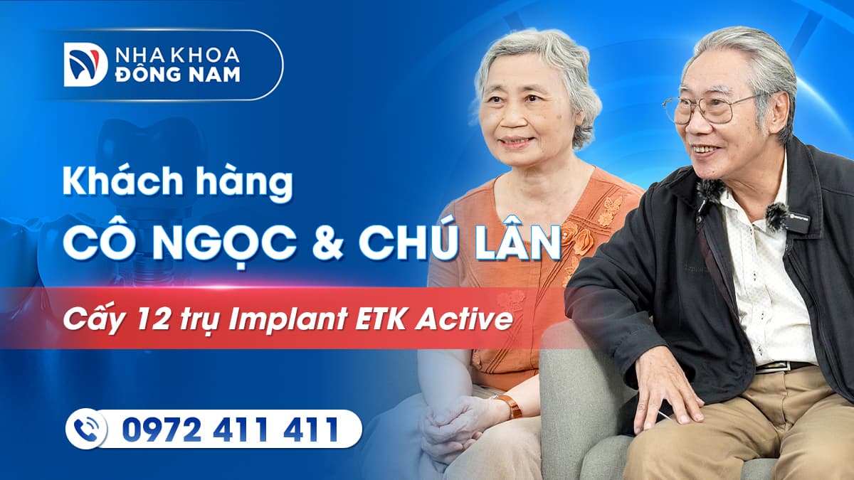 review khách hàng chú lân và cô ngọc cấy 12 trụ implant active