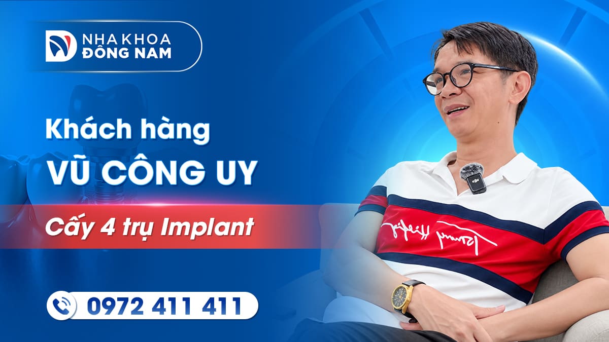 review khách hàng chú vũ công uy cấy 4 trụ implant