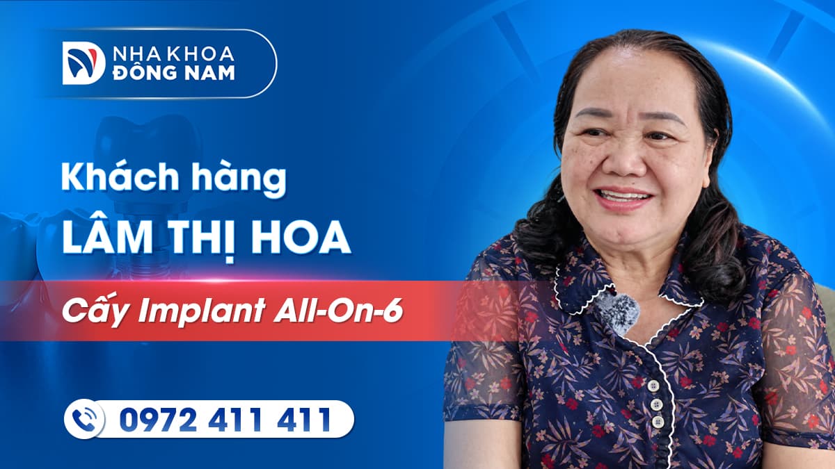 review khách hàng cô lâm thị hoa cấy implant all on 6