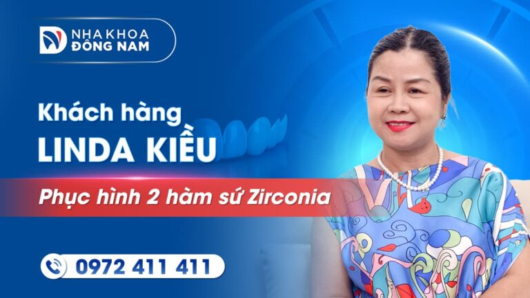 Khách hàng Linda Kiều bọc răng sứ thẩm mỹ 2 hàm