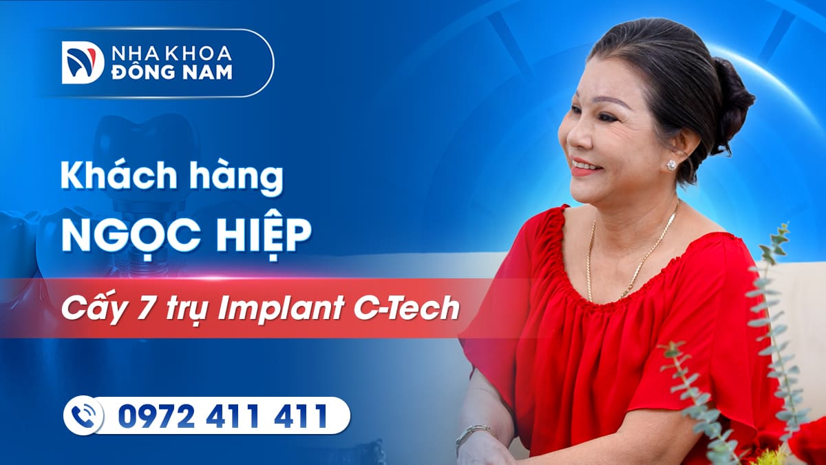 review khách hàng cô ngọc hiệp cấy 7 trụ implant