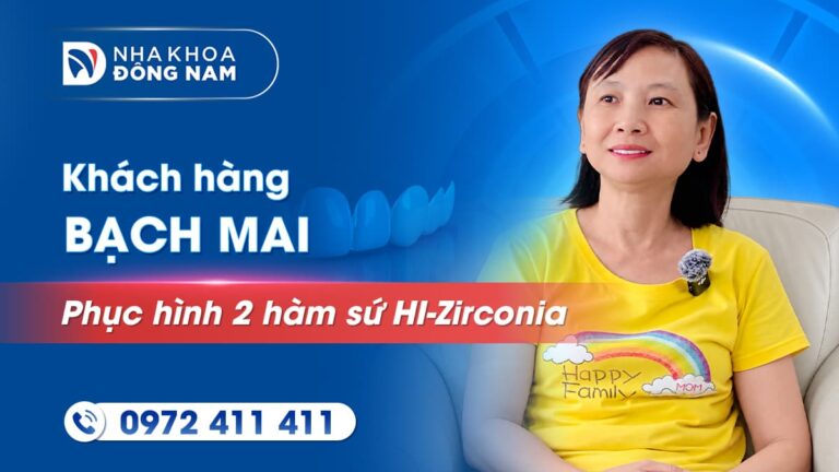 Khách hàng Bạch Mai tái khám sau 6 năm phục hình sứ 2 hàm