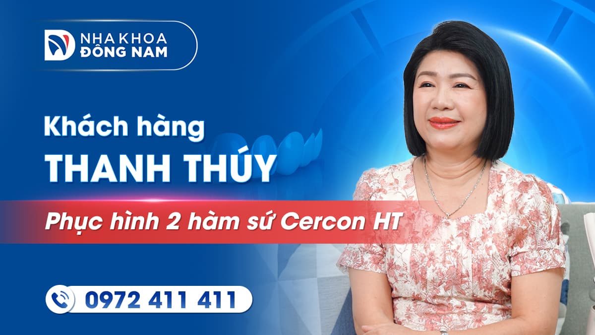 review khách hàng cô thanh thúy phục hình 2 hàm răng toàn sứ