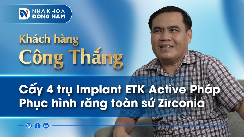 Anh Trương Công Thắng cấy 4 trụ Implant Hàn Quốc tại Nha Khoa Đông Nam