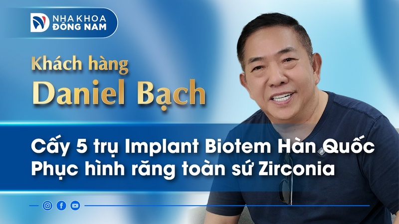 review khách hàng daniel bạch cấy 5 trụ implant biotem hàn quốc